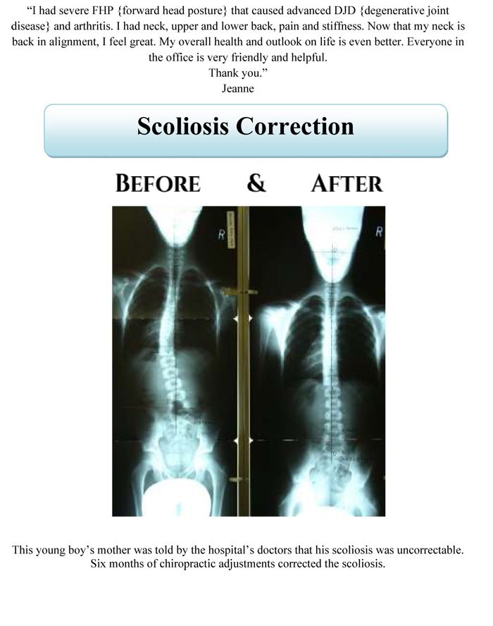 Before & After XRays Aspen Ridge Chiropractic