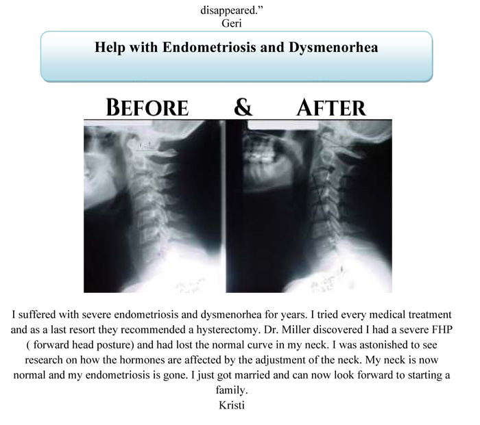 Before & After XRays Aspen Ridge Chiropractic