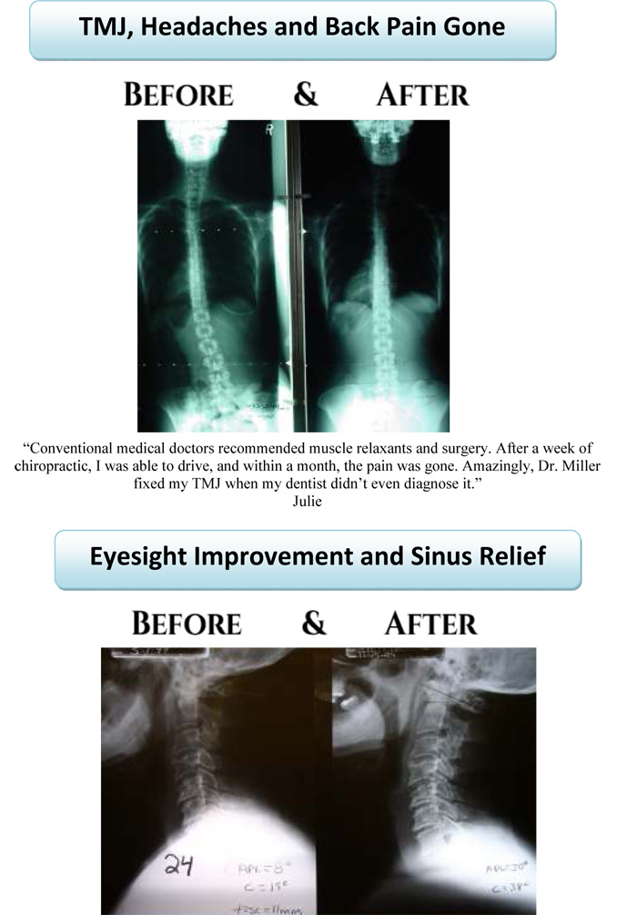Before & After XRays Aspen Ridge Chiropractic